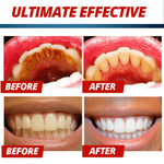 Non-fluoride bleaching toothpaste - Simooe 