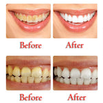 Non-fluoride bleaching toothpaste - Simooe 