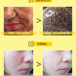 Peel off dead skin clean pores - Simooe 