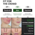 Treating acne and pimples - Simooe 