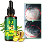 liquid Fast Hair Growth Hair Loss  Treatment - Simooe 