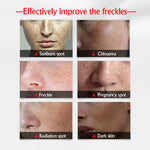 Whitening Freckle Face Cream Cell Repair - Simooe 