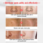 Whitening Freckle Face Cream Cell Repair - Simooe 