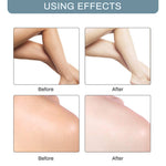 Cream to whiten  the armpits and black areas in the body - Simooe 