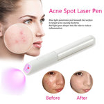 Topical phototherapy for acne goals - Simooe 