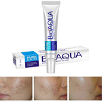 Cream Treatment Blackhead Remove Anti Acne - Simooe 