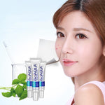 Cream Treatment Blackhead Remove Anti Acne - Simooe 