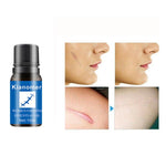 Removal Oil Nourishing Skin Lightening - Simooe 