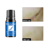 Removal Oil Nourishing Skin Lightening - Simooe 