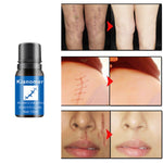 Removal Oil Nourishing Skin Lightening - Simooe 