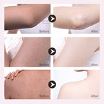 Skin Whitening Cream - Simooe 