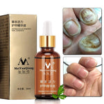Fungal Nail Treatment Feet