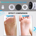 For baby skin feet