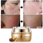 Moisturizing Face Cream the Removal Spot Anti-Wrinkle Cream - Simooe 