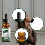 Treating acne and pimples - Simooe 